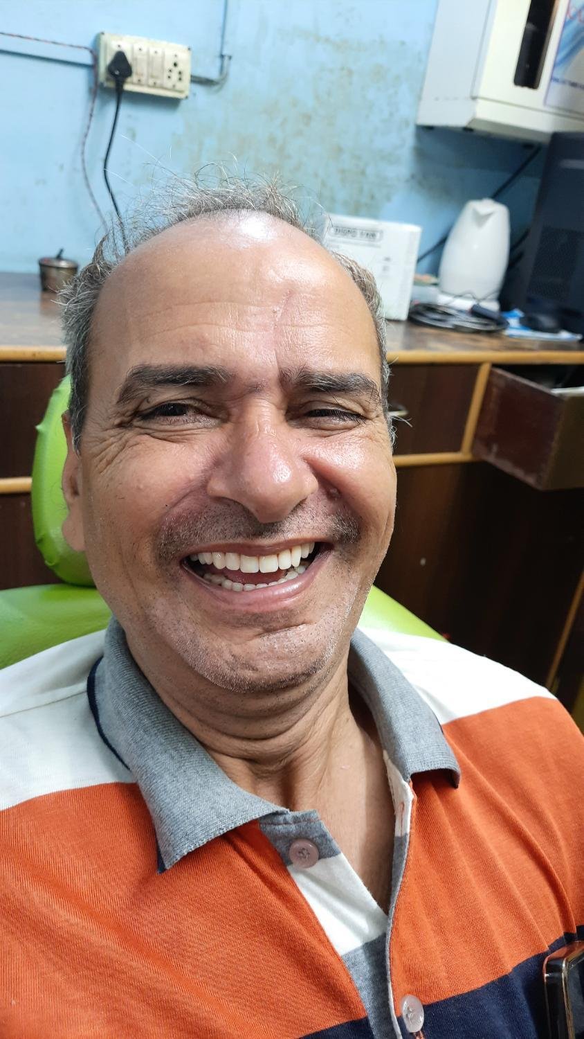 Patient smiling after treatment